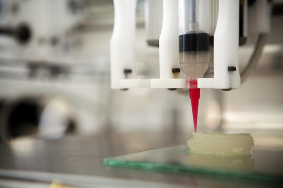 Инновации: 3D печать поможет восстанавливать межпозвоночные диски