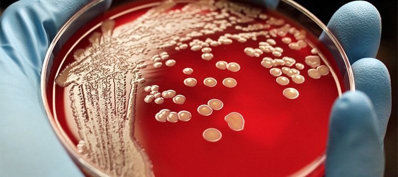 Новости: ВОЗ призвала создавать новые антибиотики