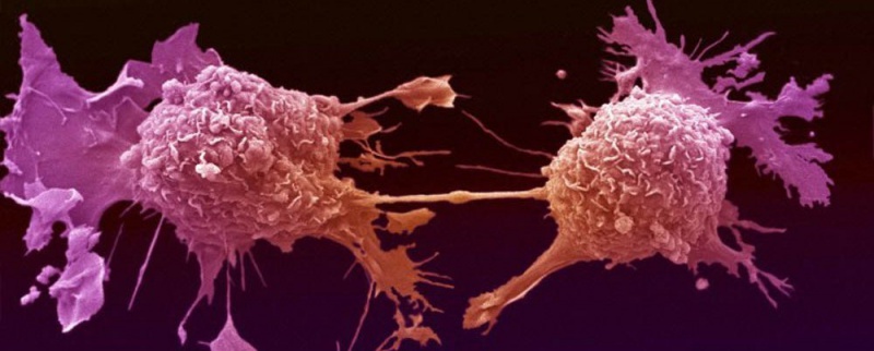 Знание - сила!: Раковые клетки получают энергию для бурного роста при расщеплении сахара